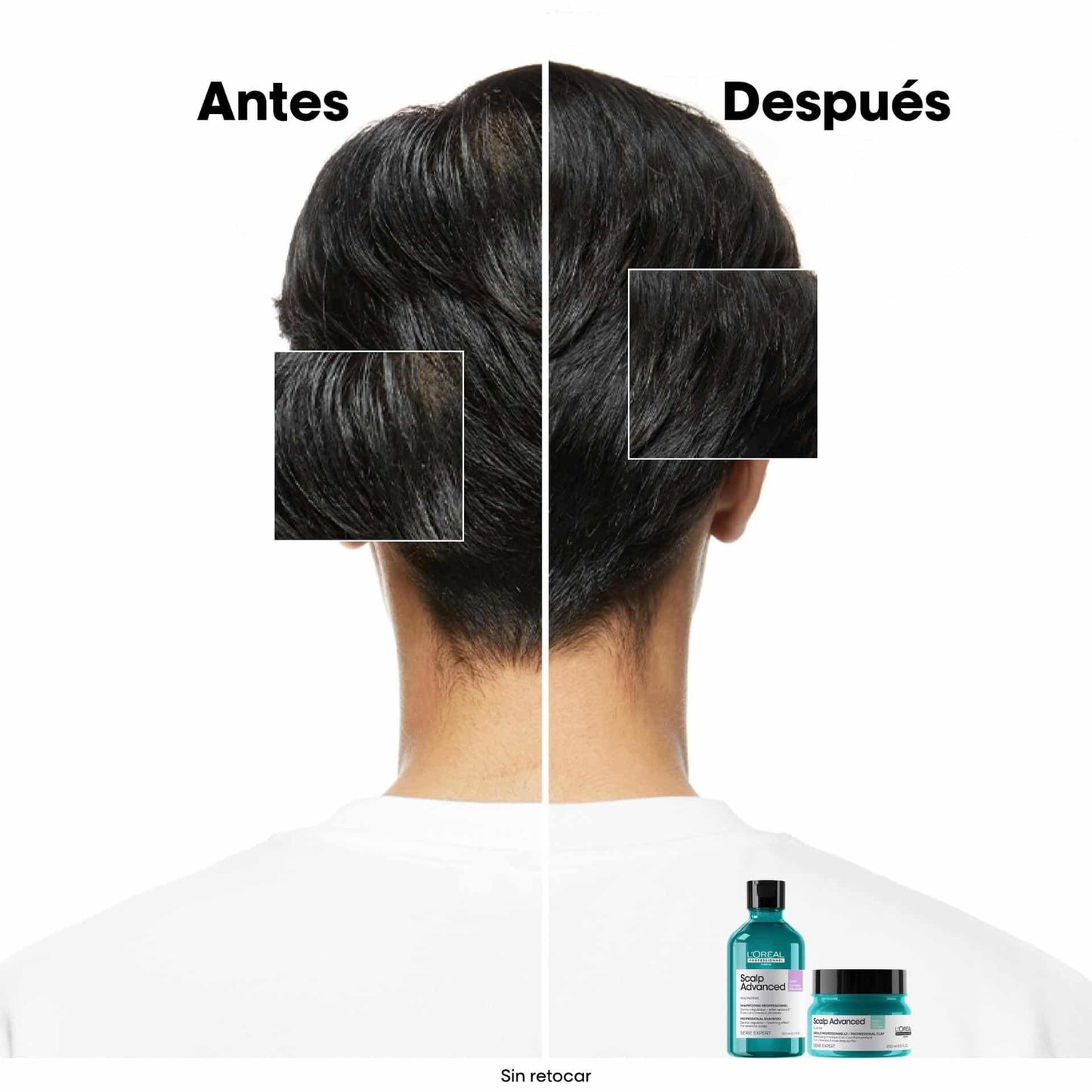 Scalp Advanced Anti-Oiliness Shampoo