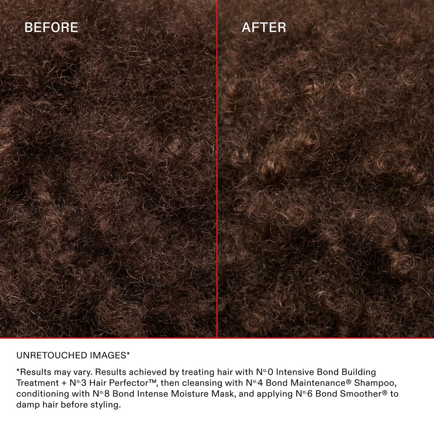 No. 0 Intensive Bond Building Treatment