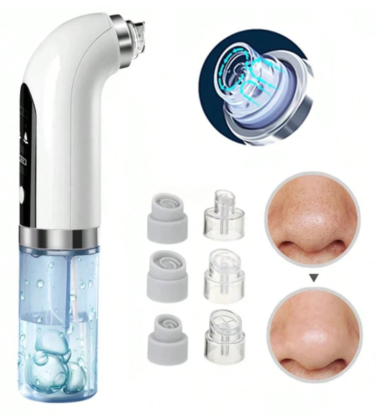 Succionador Eléctrico de Puntos Negros