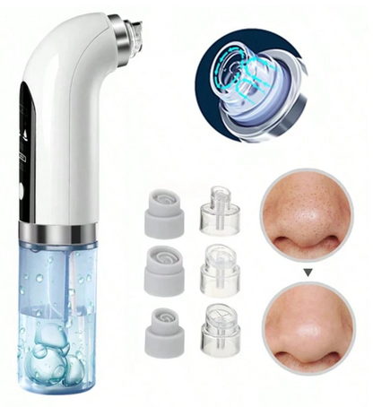 Succionador Eléctrico de Puntos Negros