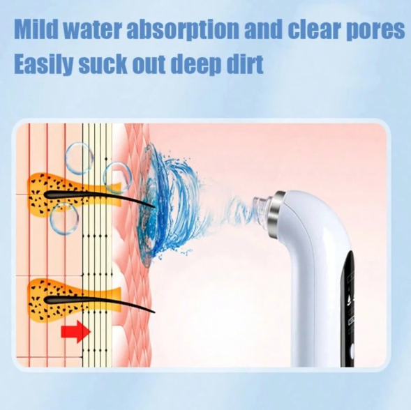 Succionador Eléctrico de Puntos Negros